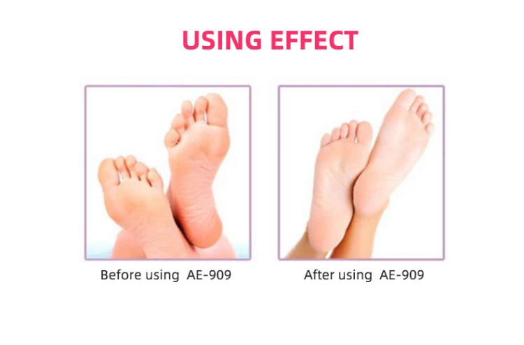 Professional 4 in 1 Electric Foot File & Callus Remover Waterproof Rotating Manicure & Pedicure Kits for Foot Care